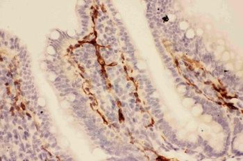 Adiponectin/ADIPOQ Rabbit Polyclonal Antibody