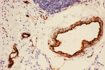 Adiponectin/ADIPOQ Rabbit Polyclonal Antibody