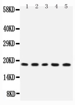 IL2 Rabbit Polyclonal Antibody