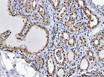 BRCA1 Rabbit Polyclonal Antibody