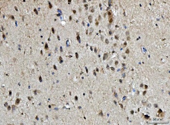 BRCA1 Rabbit Polyclonal Antibody