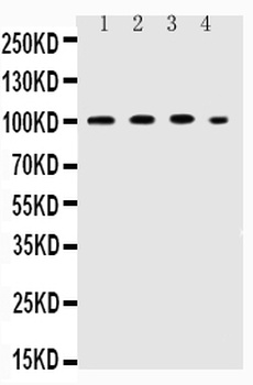 ICAM1 Rabbit Polyclonal Antibody