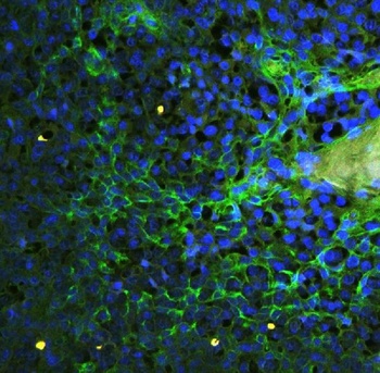 ICAM1 Rabbit Polyclonal Antibody