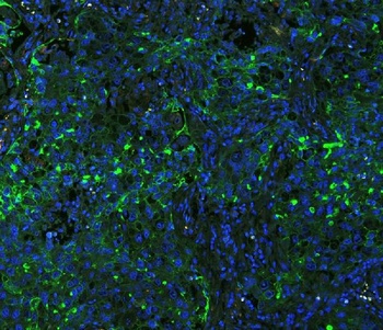 ICAM1 Rabbit Polyclonal Antibody