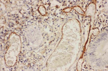 ICAM1 Rabbit Polyclonal Antibody