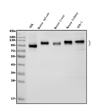 ICAM1 Rabbit Polyclonal Antibody