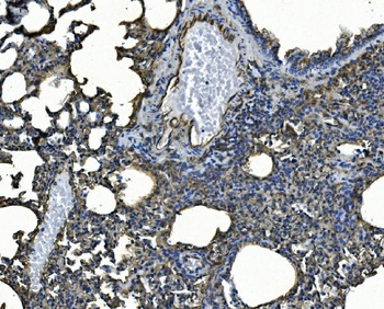 ICAM1 Rabbit Polyclonal Antibody