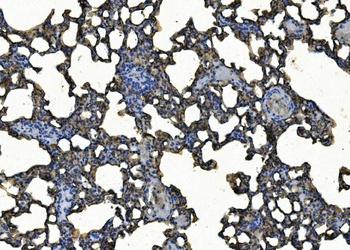ICAM1 Rabbit Polyclonal Antibody