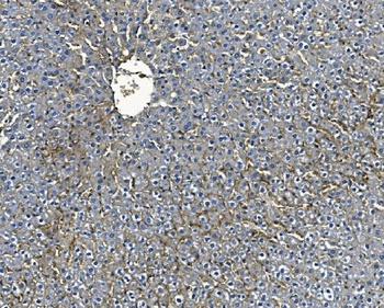 ICAM1 Rabbit Polyclonal Antibody