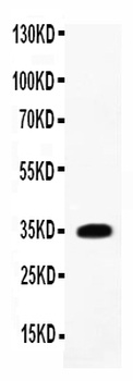 IL1 beta/IL1B Rabbit Polyclonal Antibody