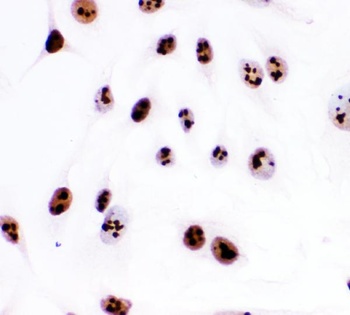 Ki67/MKI67 Rabbit Polyclonal Antibody