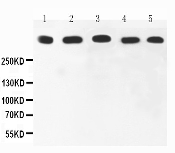 Ki67/MKI67 Rabbit Polyclonal Antibody