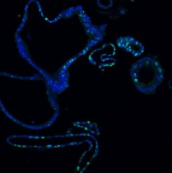 Ki67/MKI67 Rabbit Polyclonal Antibody