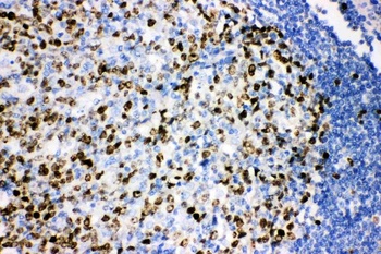 Ki67/MKI67 Rabbit Polyclonal Antibody