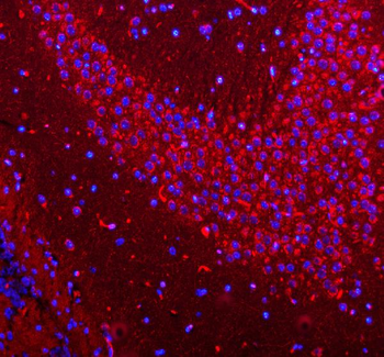 HCRT Rabbit Polyclonal Antibody