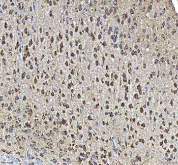 HCRT Rabbit Polyclonal Antibody