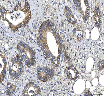 Huntingtin/HTT Rabbit Polyclonal Antibody
