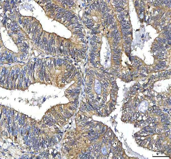 Huntingtin/HTT Rabbit Polyclonal Antibody