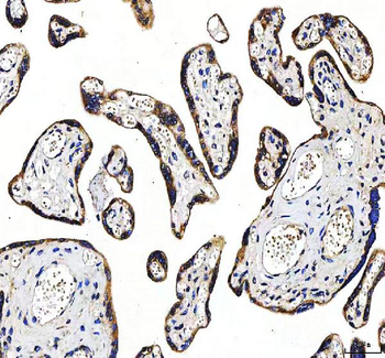 Huntingtin/HTT Rabbit Polyclonal Antibody