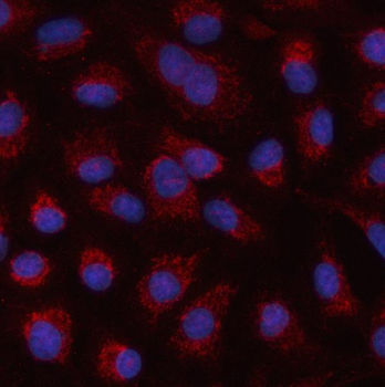 HSPA4L Rabbit Polyclonal Antibody