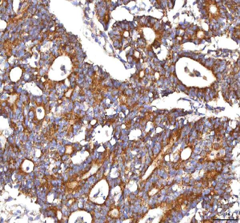 HSDL2 Rabbit Polyclonal Antibody