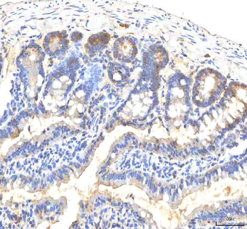 ITPA Rabbit Polyclonal Antibody