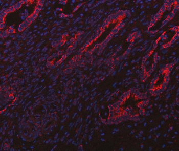 ITPA Rabbit Polyclonal Antibody