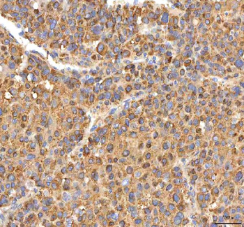 ITPA Rabbit Polyclonal Antibody