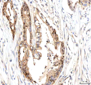 ISYNA1 Rabbit Polyclonal Antibody