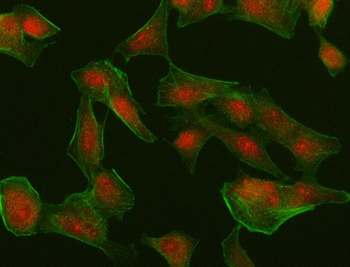 MUM1/IRF4 Rabbit Polyclonal Antibody
