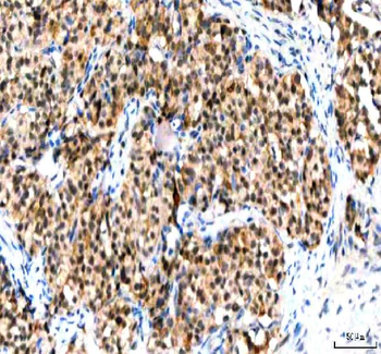 IPO9 Rabbit Polyclonal Antibody