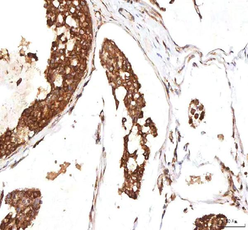 INTU Rabbit Polyclonal Antibody