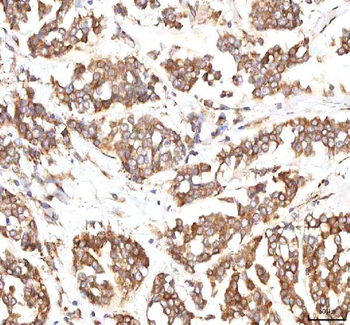 INTU Rabbit Polyclonal Antibody