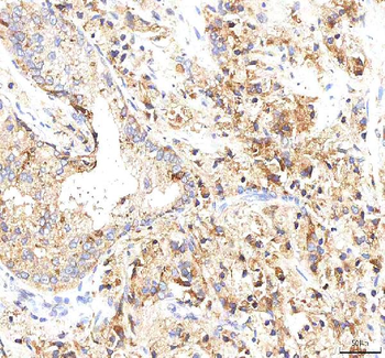INTU Rabbit Polyclonal Antibody