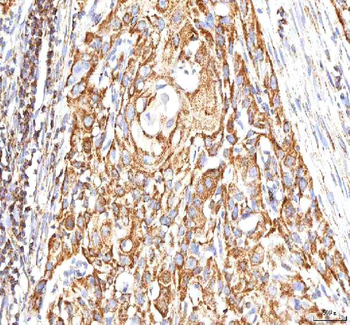 Calreticulin/CALR Rabbit Polyclonal Antibody