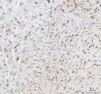 Calreticulin/CALR Rabbit Polyclonal Antibody