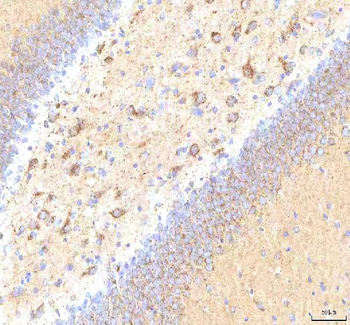 Calreticulin/CALR Rabbit Polyclonal Antibody