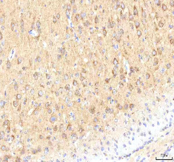 Calreticulin/CALR Rabbit Polyclonal Antibody