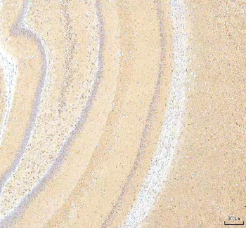 Calreticulin/CALR Rabbit Polyclonal Antibody