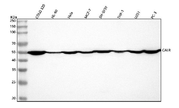 Calreticulin/CALR Rabbit Polyclonal Antibody