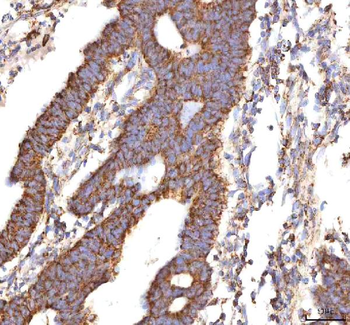 Calreticulin/CALR Rabbit Polyclonal Antibody