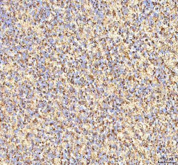 Calreticulin/CALR Rabbit Polyclonal Antibody