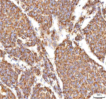 Calreticulin/CALR Rabbit Polyclonal Antibody