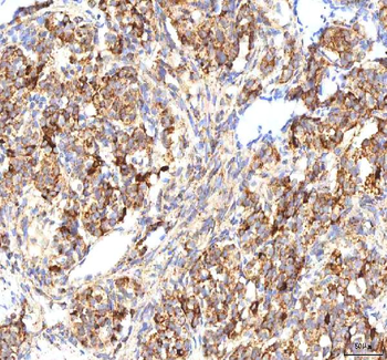 Calreticulin/CALR Rabbit Polyclonal Antibody