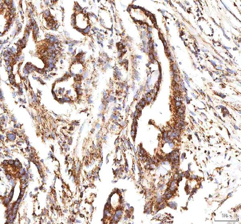 Calreticulin/CALR Rabbit Polyclonal Antibody