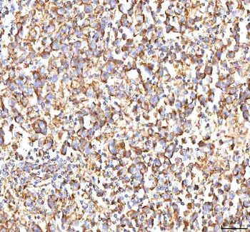Calreticulin/CALR Rabbit Polyclonal Antibody