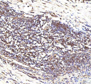 Calreticulin/CALR Rabbit Polyclonal Antibody