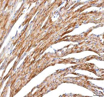 Hcn2 Rabbit Polyclonal Antibody