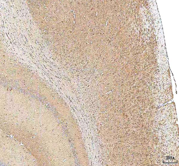 Hcn2 Rabbit Polyclonal Antibody