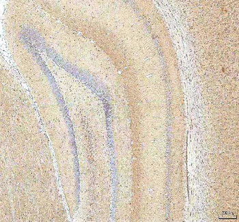Hcn2 Rabbit Polyclonal Antibody